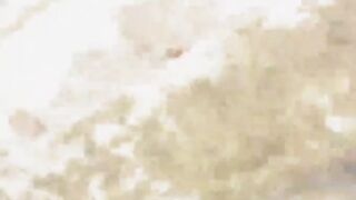 보지털 뽑고 도망가기 (2)